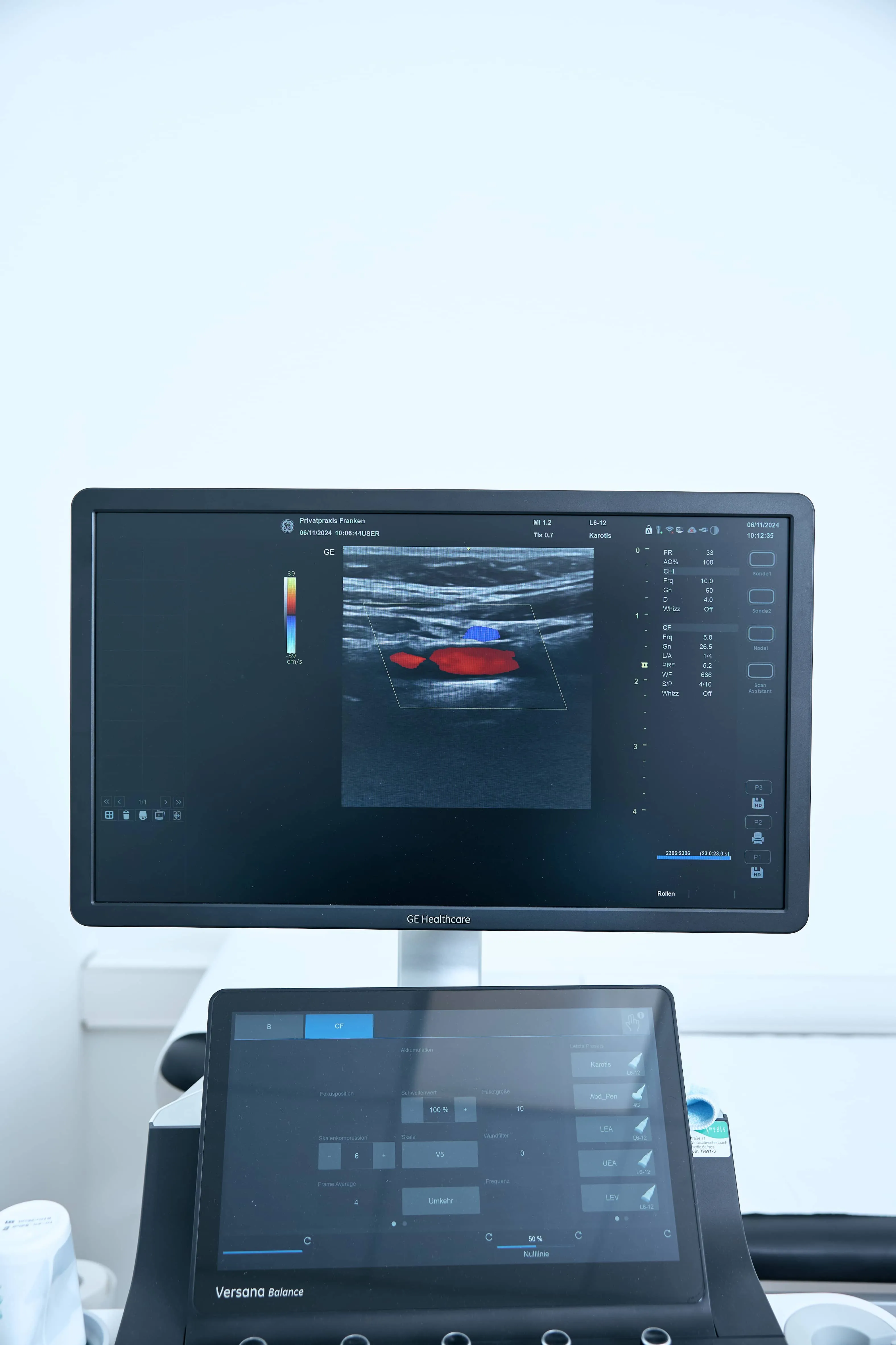 GE Versana Balance Duplex-Ultraschallgerät in der Privatpraxis